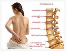 Pilates and bad back